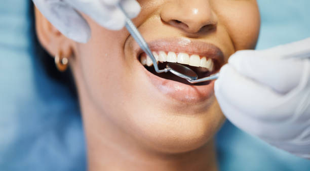 Best Emergency Dental Extractions in Wrens, GA