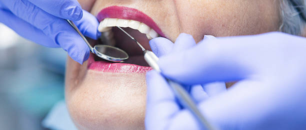 Best Broken or Cracked Tooth Emergency Dentist in Wrens, GA